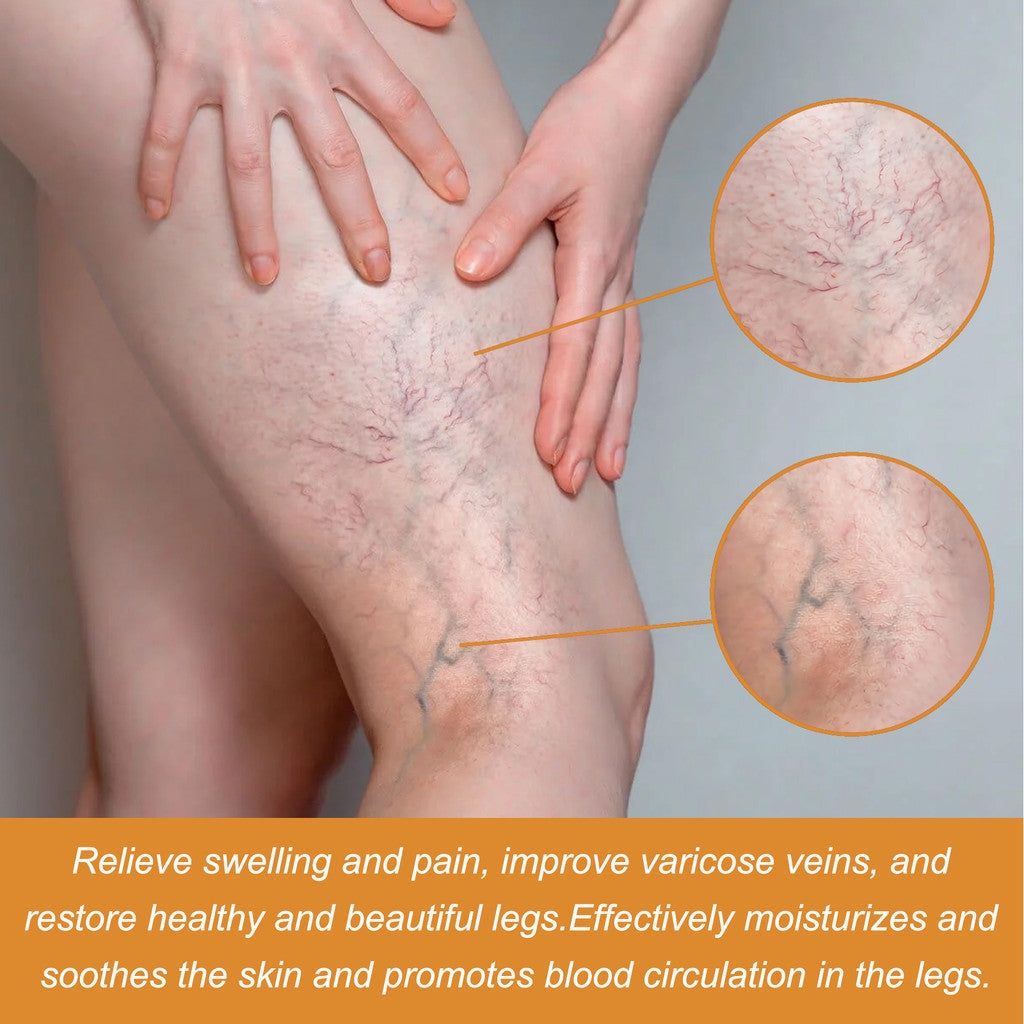 Turmeric Varicose Vein Relief Spray( BUY 1 GET 2 FREE💥 🎁  )